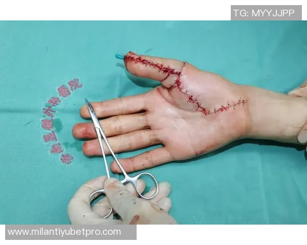 黄威手术时间确定将于10月10日进行恢复计划全力以赴期待重返赛场